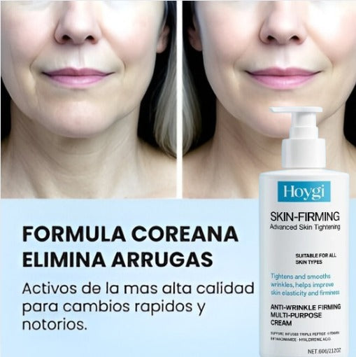 HOYGI™ Skin-Firming | Crema Reafirmante