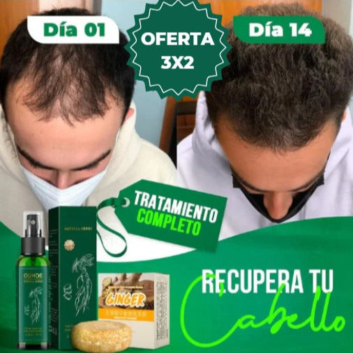 OUHOE Spray Capilar™ | Cabello Fuerte y Abundante