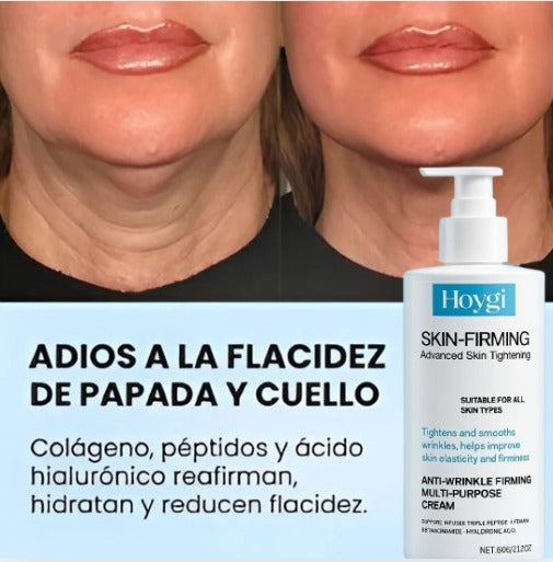 HOYGI™ Skin-Firming | Crema Reafirmante